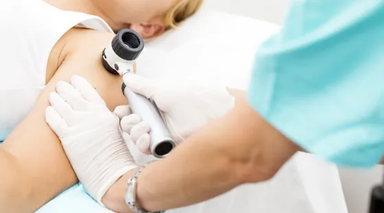 FREE Skin Cancer Screening